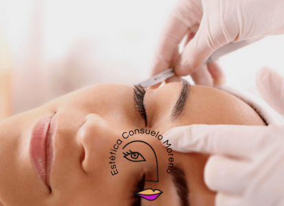 dermaplaning Estetica Consuelo Moreno