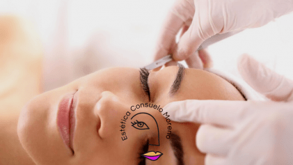 dermaplaning Estetica Consuelo Moreno