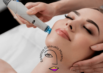 Dermapen