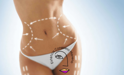 Lipolisis laser Pembroke Pines