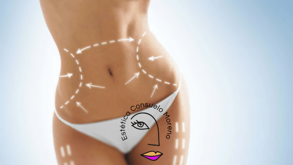 Lipolisis laser Pembroke Pines